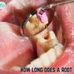 How Long Does a Root Canal Take